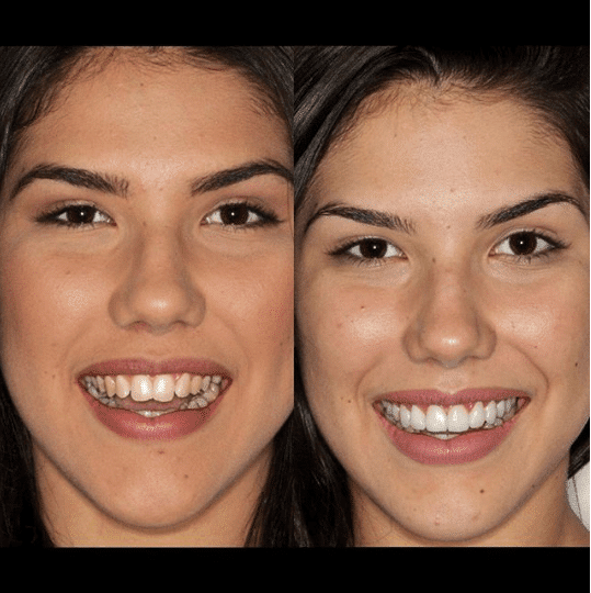 Instagram para dentistas - divulgar antes x depois
