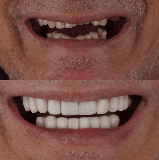 Instagram para dentistas - divulgar antes x depois
