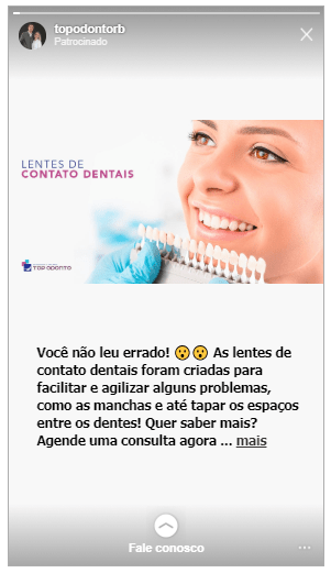 Instagram para dentistas - posts patrocinados nos stories